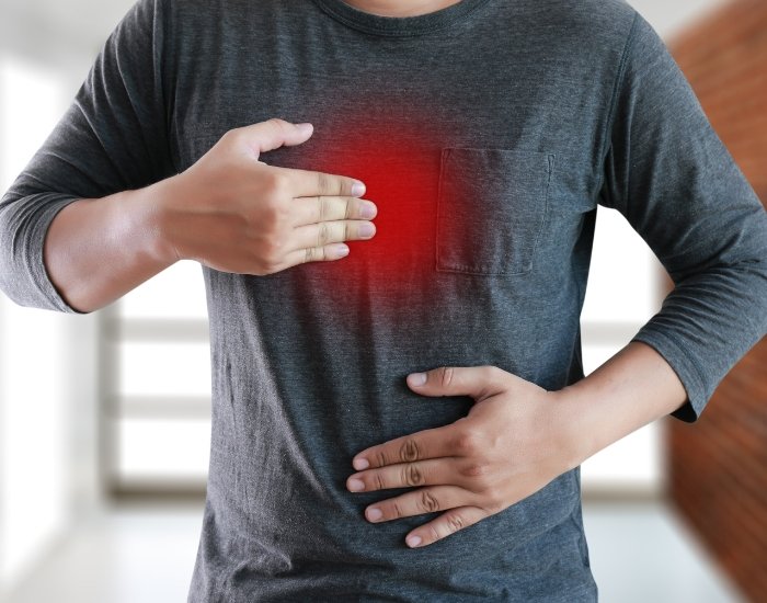 Chest Pain from Acid Reflux