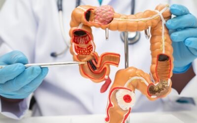 Best Gastroenterologist in Katy TX – What to Look For